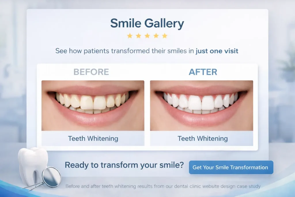Dental clinic website design smile gallery showing a before and after teeth whitening result with call to action for smile transformation